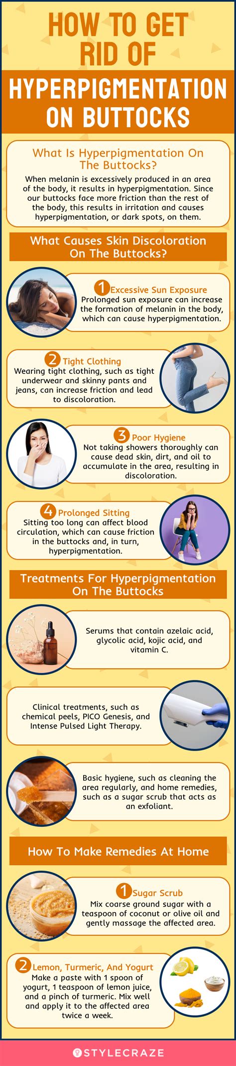 how to lighten butt crack|Hyperpigmentation On Buttocks: Causes, Tips, And Treatments .